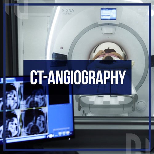 CT-Angiography